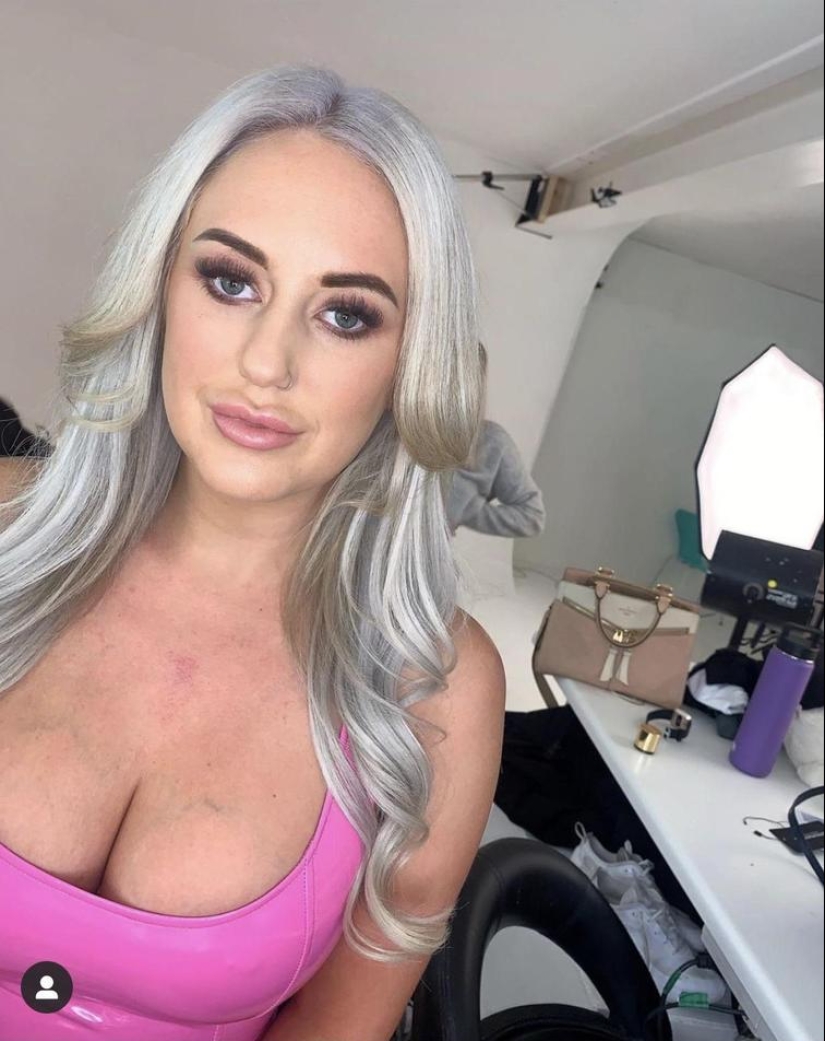 30 people who got carried away with plastic surgery and forgot to stop 30 people who got carried away with plastic surgery and forgot to stop