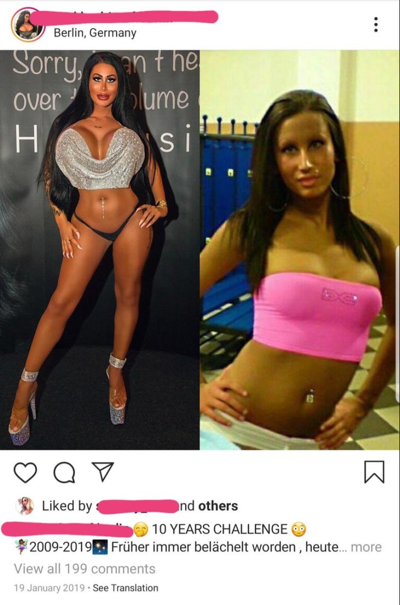 30 people who got carried away with plastic surgery and forgot to stop 30 people who got carried away with plastic surgery and forgot to stop