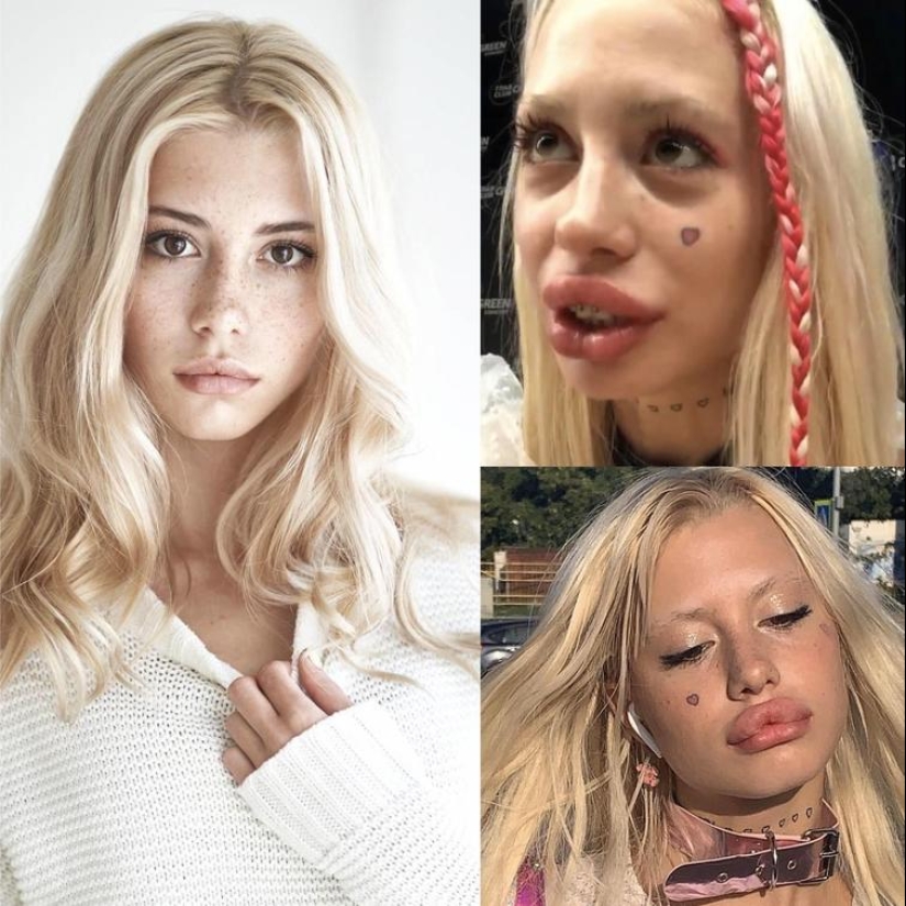 30 people who got carried away with plastic surgery and forgot to stop 30 people who got carried away with plastic surgery and forgot to stop