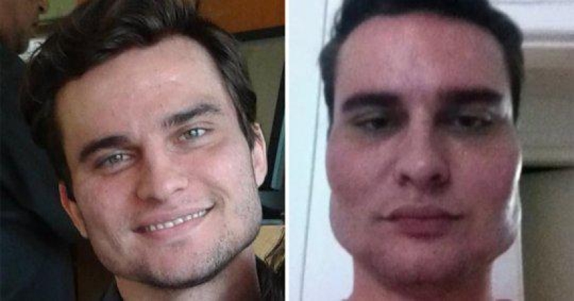 30 personas que se dejaron llevar por la cirugía plástica y se olvidaron de parar