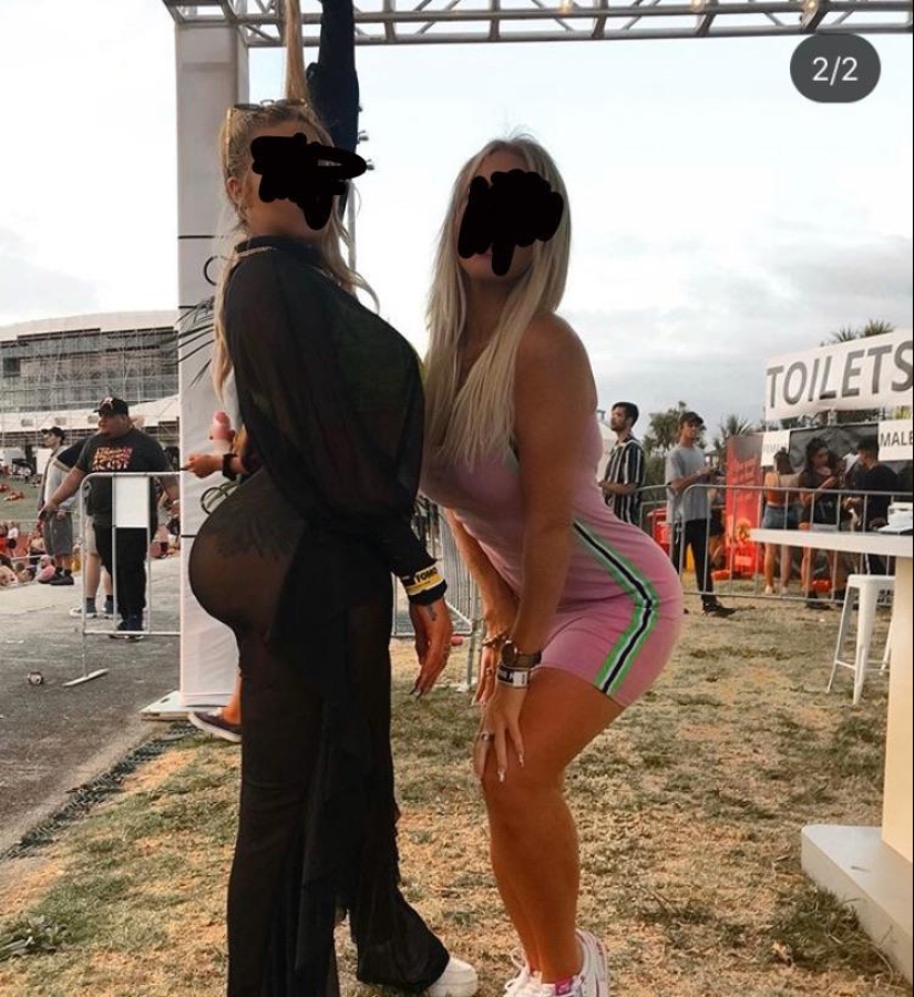 30 personas que se dejaron llevar por la cirugía plástica y se olvidaron de parar