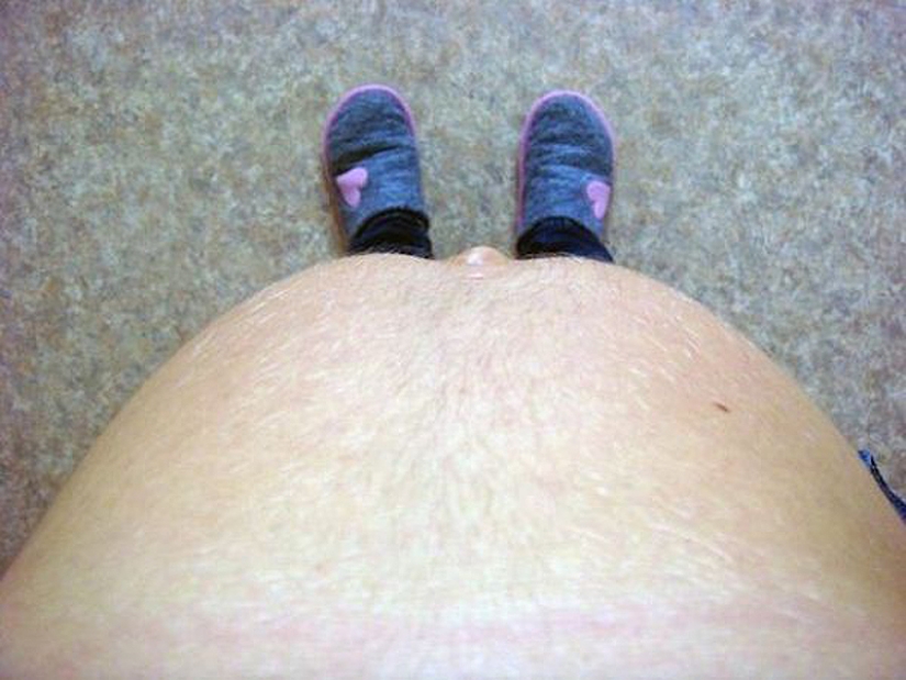 7 datos sobre la grasa abdominal