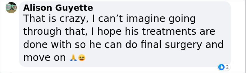 A un hombre que se sometió a cirugías de extirpación del cráneo para “lavar” su cerebro se le niegan beneficios por discapacidad