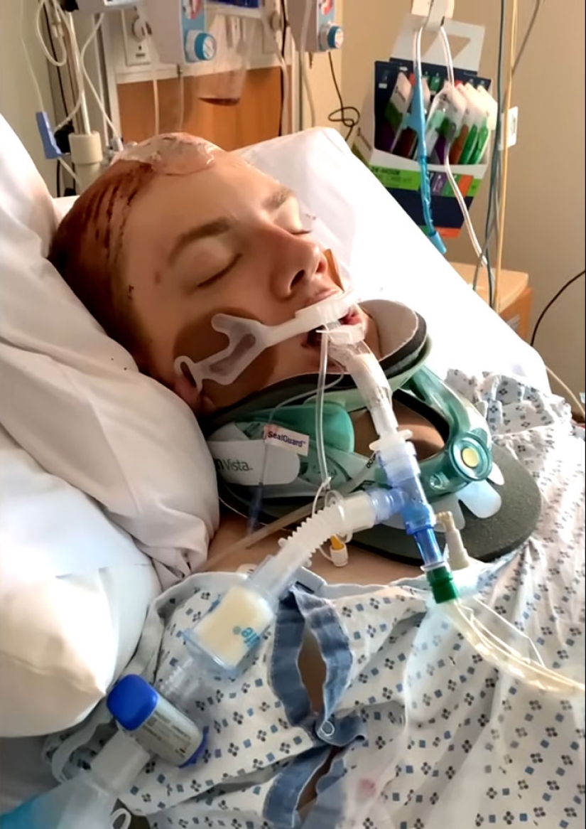 A un hombre que se sometió a cirugías de extirpación del cráneo para “lavar” su cerebro se le niegan beneficios por discapacidad