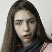 Acerca de la cara: retratos fotográficos de personas que sufren de parálisis