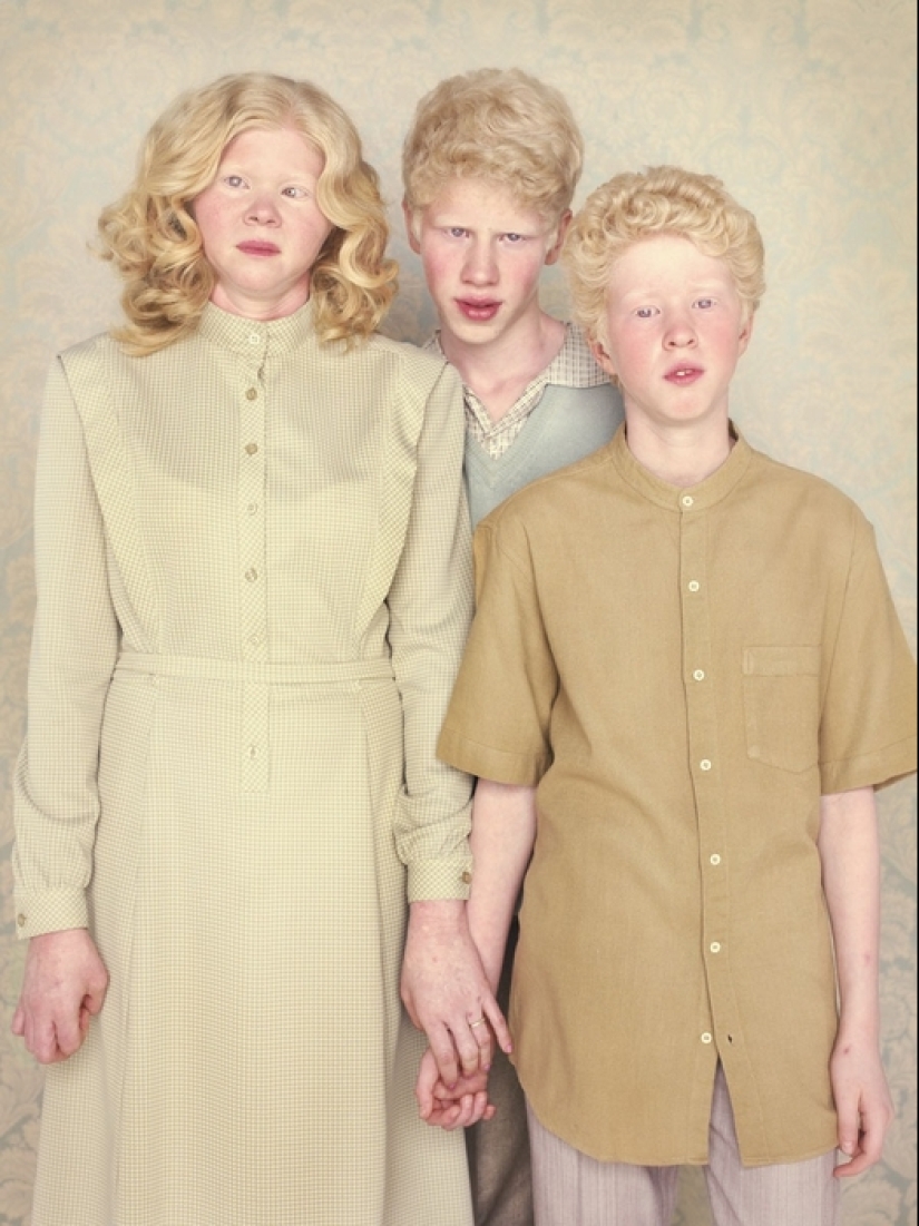 Albinos en la lente de Gustavo Lacerde