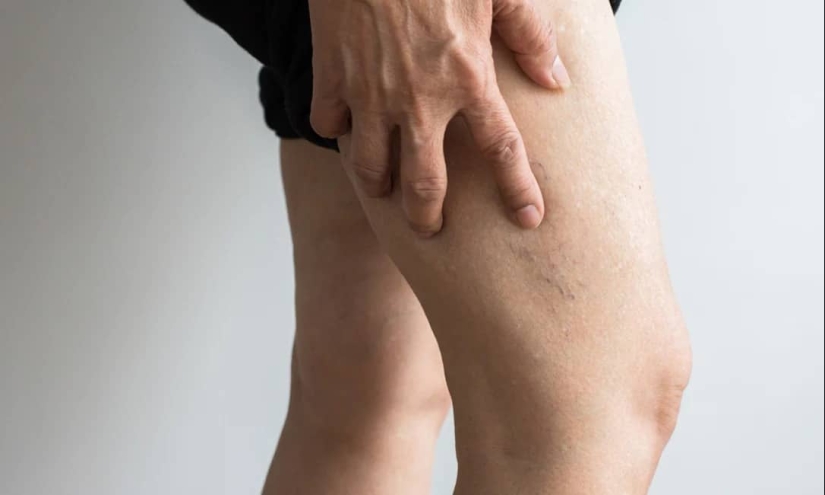 Asesino silencioso: una afección mortal que ocurre después de estar sentado en la oficina durante mucho tiempo Asesino silencioso: una afección mortal que ocurre después de estar sentado en la oficina durante mucho tiempo