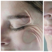 Bayu bayushki, not loisa on the side! Experts told about the dangers of sleep face down in the pillow