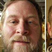 Before and after: how does the appearance of a person who stops drinking change