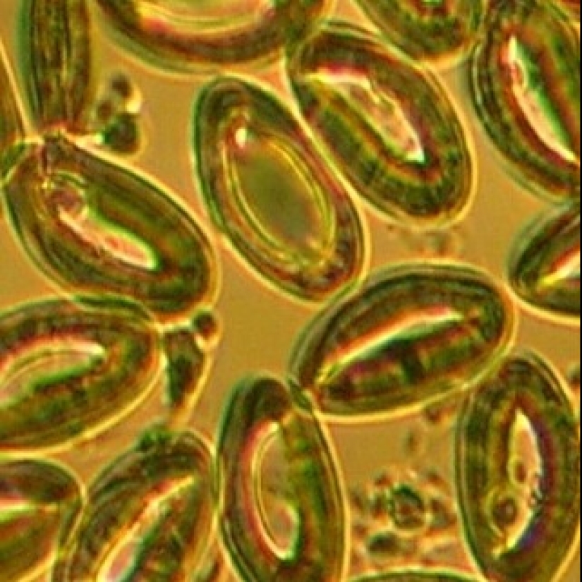 Belleza interior: un microbiólogo de Ufa muestra en Instagram los virus y bacterias que viven en nosotros Belleza interior: un microbiólogo de Ufa muestra en Instagram los virus y bacterias que viven en nosotros