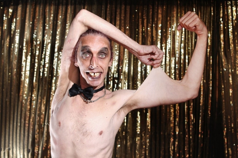 Cara de goma: cómo vive Harry Turner, el hombre con la piel más elástica del mundo Cara de goma: cómo vive Harry Turner, el hombre con la piel más elástica del mundo