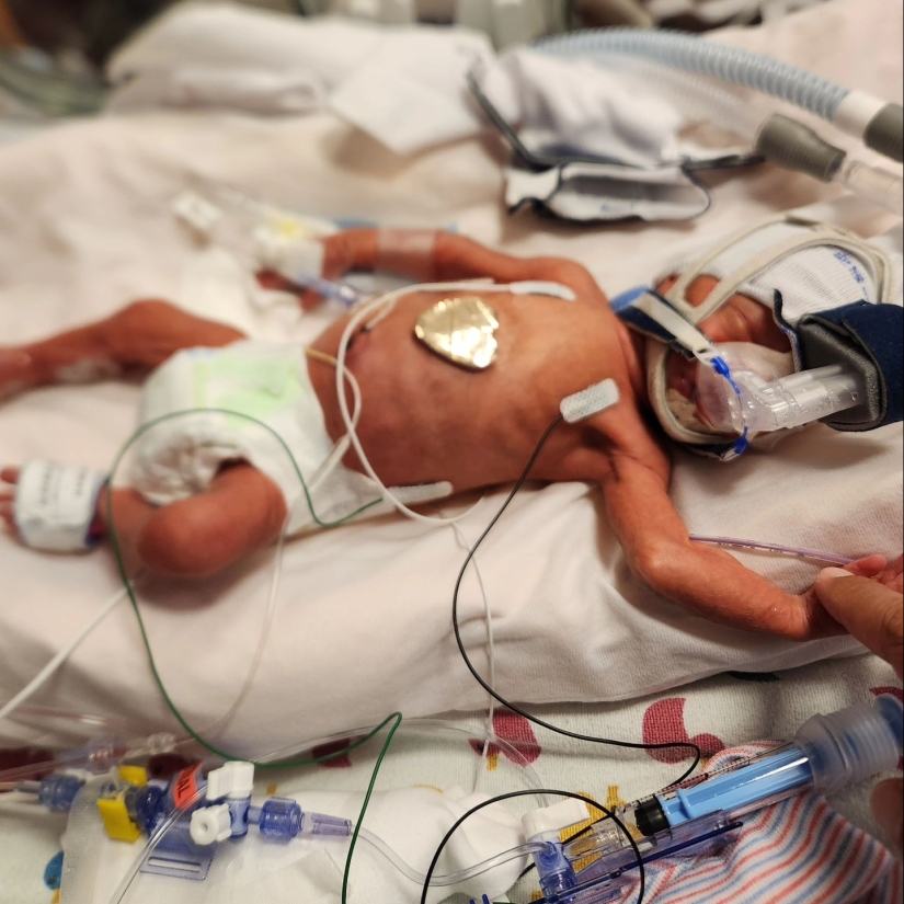 Couple Beats One-In-Fifteen-Million Odds To Welcome Identical “Miracle” Quadruplets