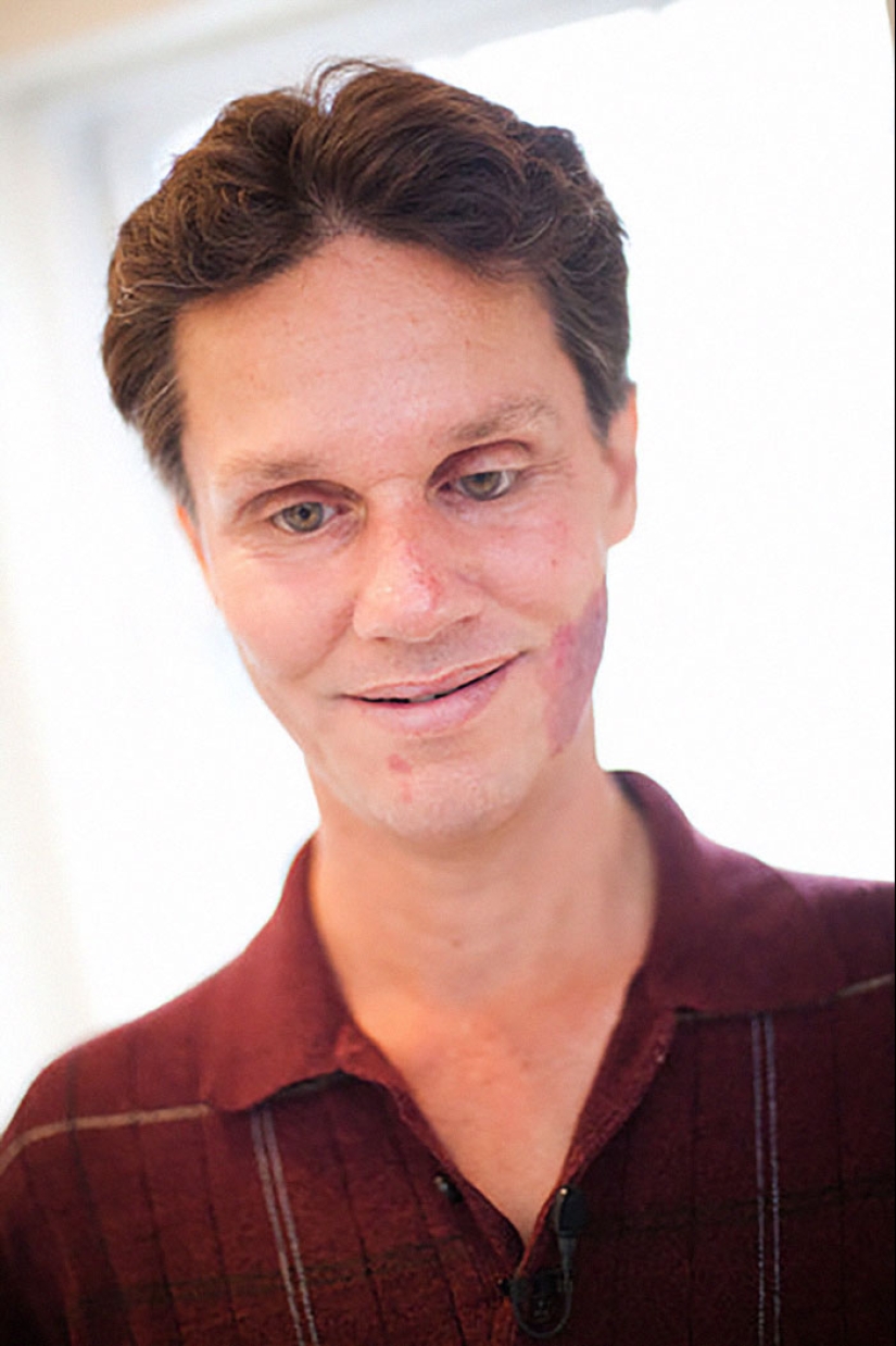 Diez personas con “superpoderes” en la vida real que desafían nuestra comprensión del cuerpo humano Diez personas con “superpoderes” en la vida real que desafían nuestra comprensión del cuerpo humano