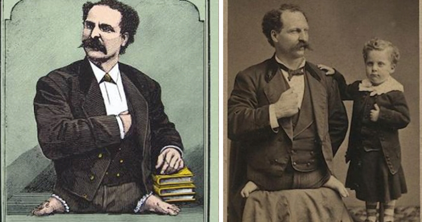 Eli Bowen - The Legless Acrobat Who Proved That Nothing Is Impossible Eli Bowen - The Legless Acrobat Who Proved That Nothing Is Impossible