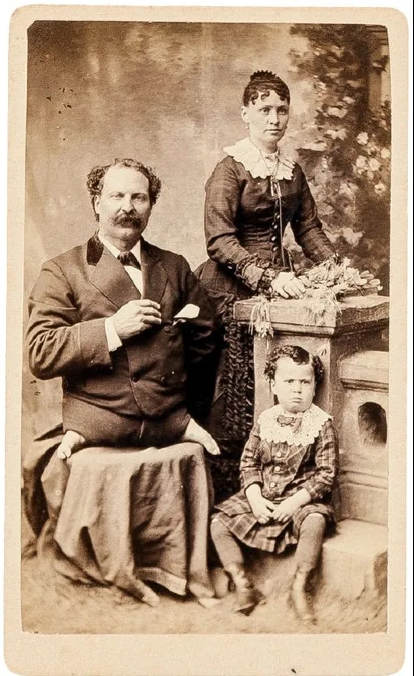 Eli Bowen - The Legless Acrobat Who Proved That Nothing Is Impossible Eli Bowen - The Legless Acrobat Who Proved That Nothing Is Impossible