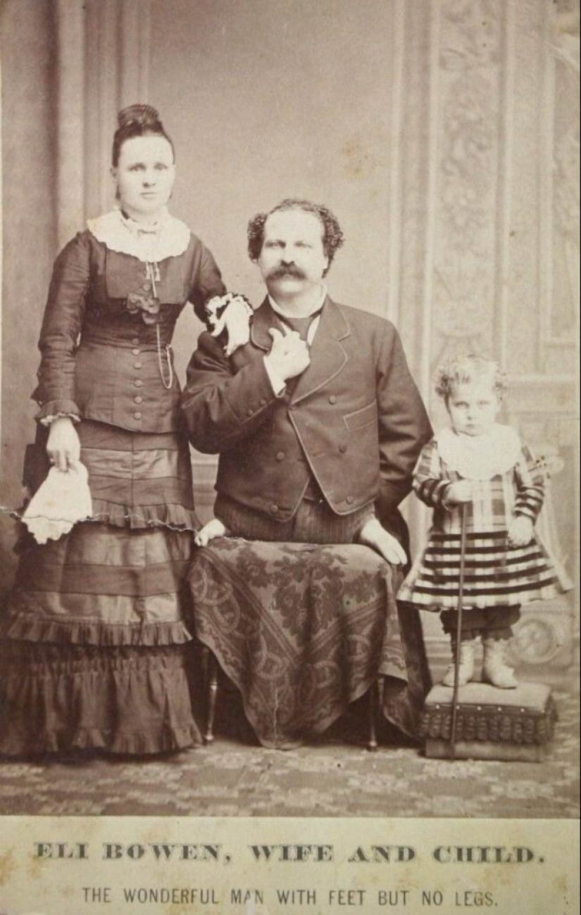 Eli Bowen - The Legless Acrobat Who Proved That Nothing Is Impossible Eli Bowen - The Legless Acrobat Who Proved That Nothing Is Impossible