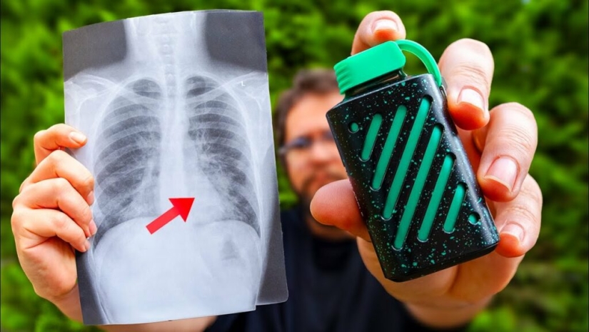 EVALI - Everything You Need to Know About E-Cigarette Lung Disease EVALI - Everything You Need to Know About E-Cigarette Lung Disease