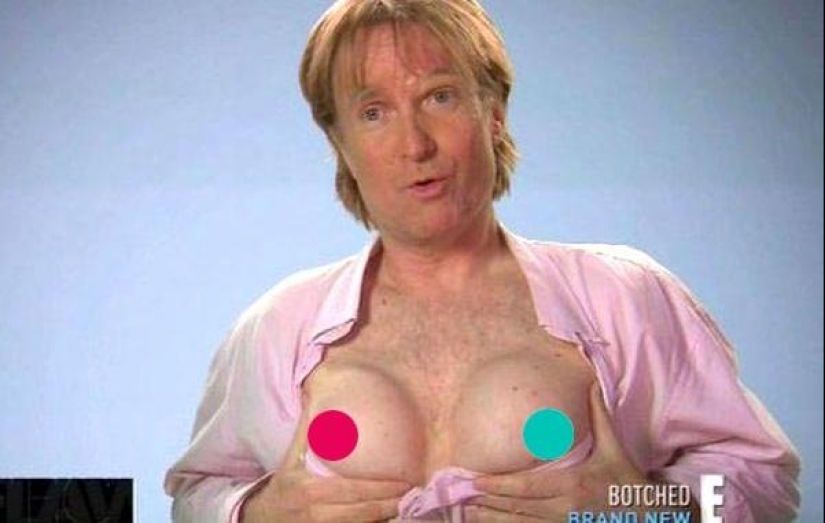 “I fell in love with my breasts”: a Canadian on a bet walked with a silicone bust for 20 years “I fell in love with my breasts”: a Canadian on a bet walked with a silicone bust for 20 years