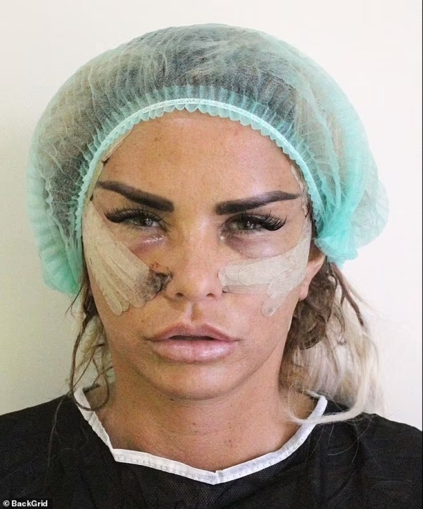 Katie Price sorprende al revelar los resultados de su 'levantamiento de trasero' en una PEQUEÑA tanga negra