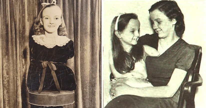 La conmovedora historia de Frida la media niña, una de las últimas estrellas de la era de los “circos freaks”