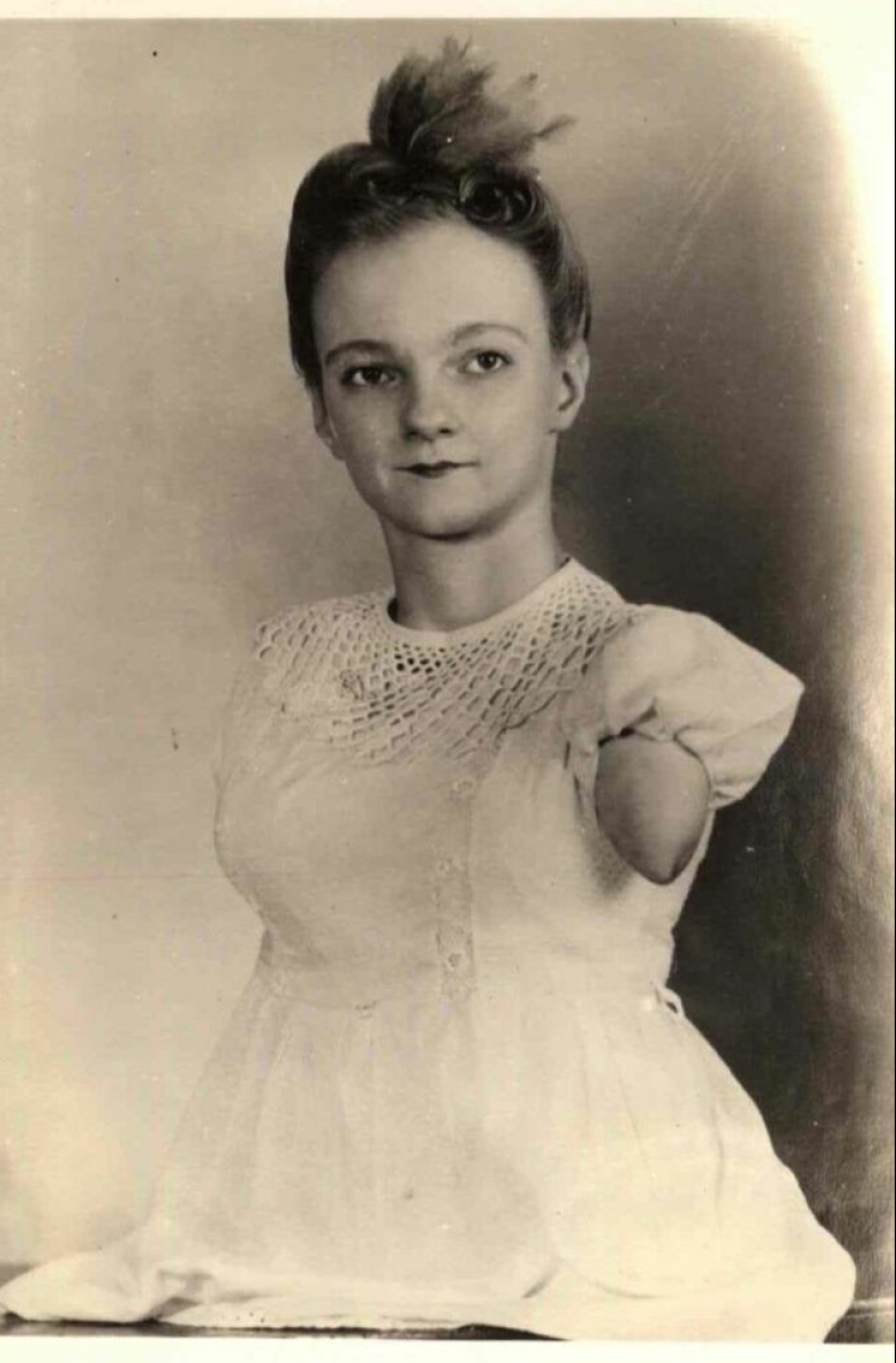 La conmovedora historia de Frida la media niña, una de las últimas estrellas de la era de los “circos freaks”