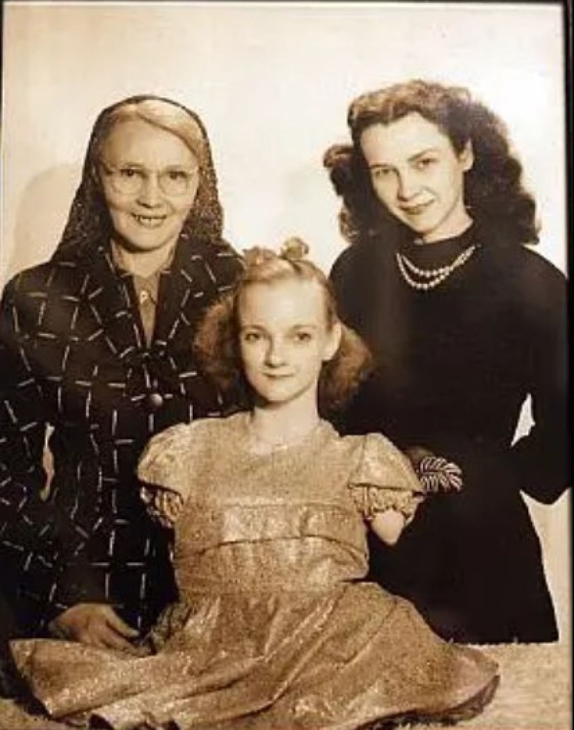 La conmovedora historia de Frida la media niña, una de las últimas estrellas de la era de los “circos freaks”