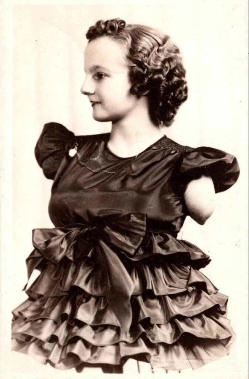 La conmovedora historia de Frida la media niña, una de las últimas estrellas de la era de los “circos freaks”