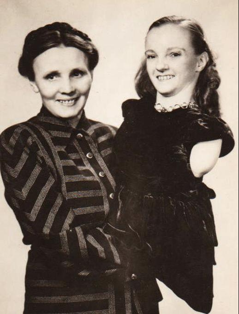 La conmovedora historia de Frida la media niña, una de las últimas estrellas de la era de los “circos freaks”