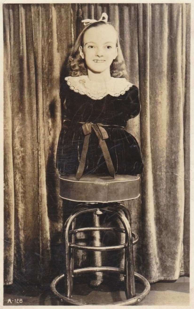 La conmovedora historia de Frida la media niña, una de las últimas estrellas de la era de los “circos freaks”