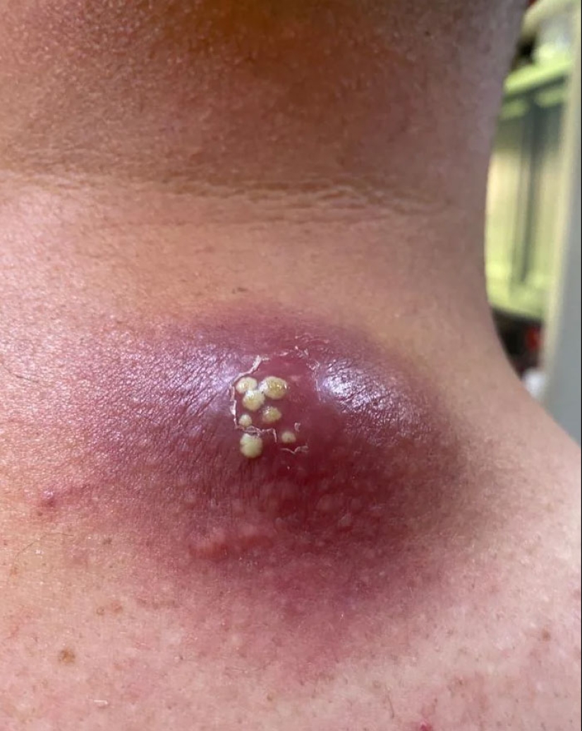 La gente comparte imágenes que hacen que otros “sufran”, y la situación empeora cuanto más las miras La gente comparte imágenes que hacen que otros “sufran”, y la situación empeora cuanto más las miras