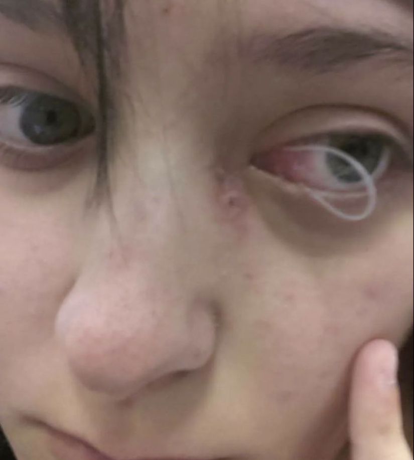 La gente comparte imágenes que hacen que otros “sufran”, y la situación empeora cuanto más las miras La gente comparte imágenes que hacen que otros “sufran”, y la situación empeora cuanto más las miras