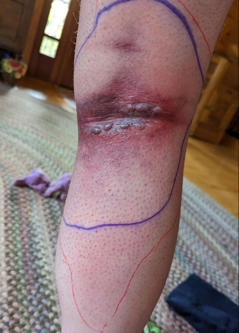 La gente comparte imágenes que hacen que otros “sufran”, y la situación empeora cuanto más las miras La gente comparte imágenes que hacen que otros “sufran”, y la situación empeora cuanto más las miras