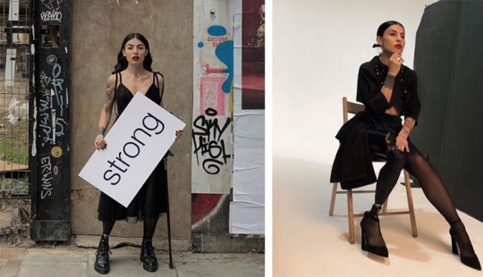 La historia de Sammy Gabriel: hermoso y fuerte, que se motiva a ser feliz no importa lo que