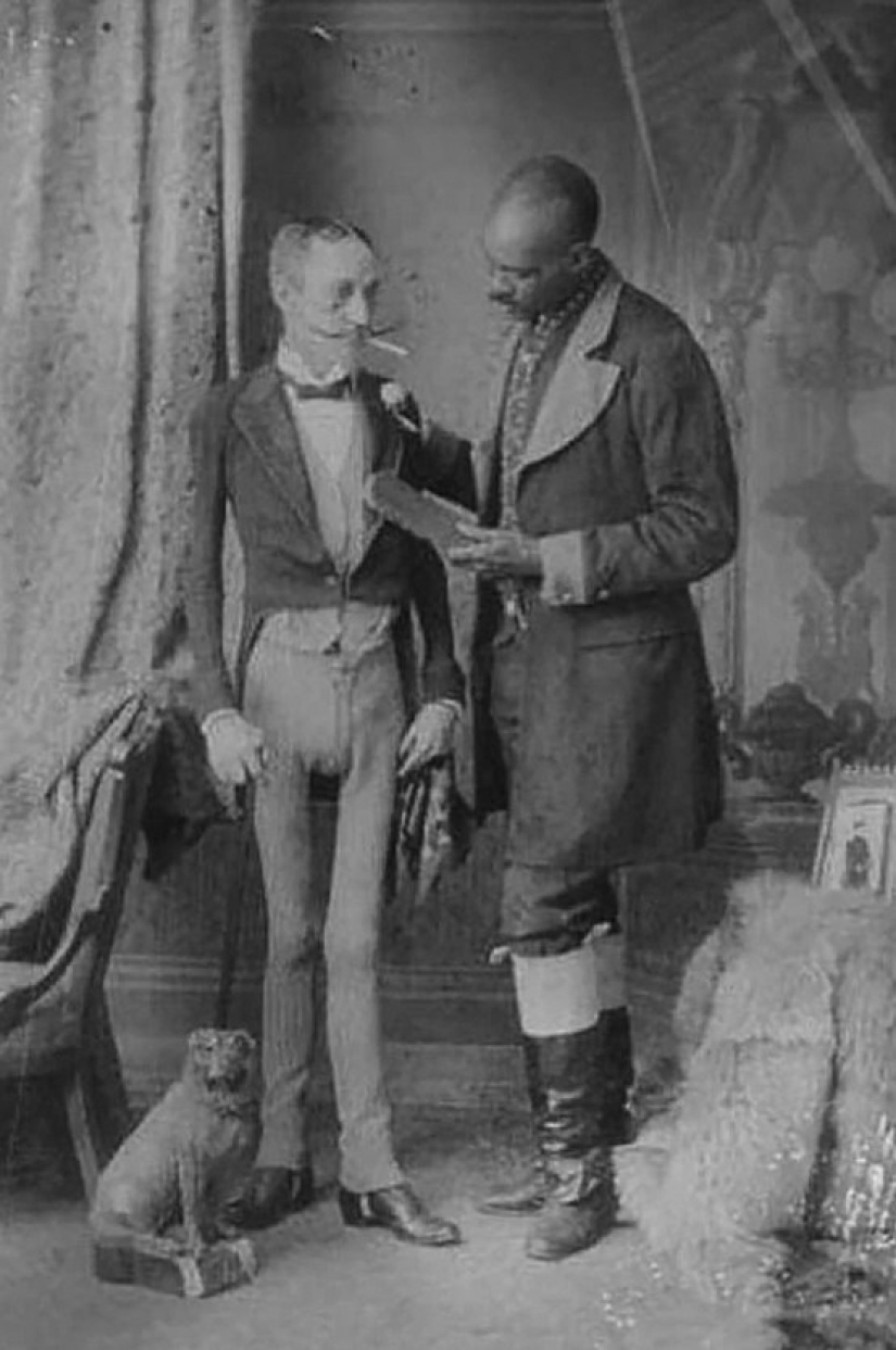 La trágica historia del "esqueleto viviente" Isaac Sprague