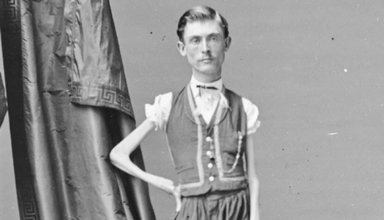 La trágica historia del "esqueleto viviente" Isaac Sprague La trágica historia del "esqueleto viviente" Isaac Sprague