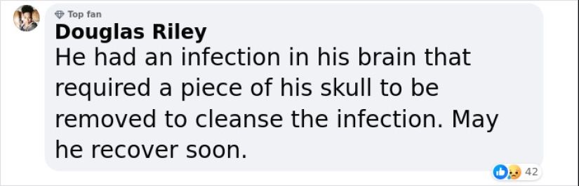 Man Who Underwent Skull Removal Surgeries To “Wash” His Brain Gets Denied Disability Benefits