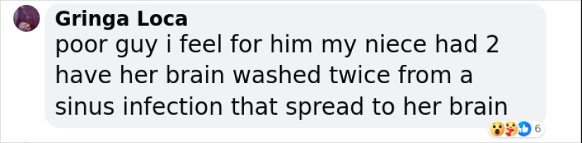 Man Who Underwent Skull Removal Surgeries To “Wash” His Brain Gets Denied Disability Benefits