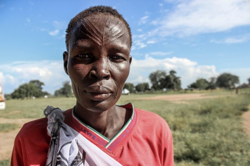 Monobrow, braces and 8 more appearance flaws that are considered attractive by other peoples