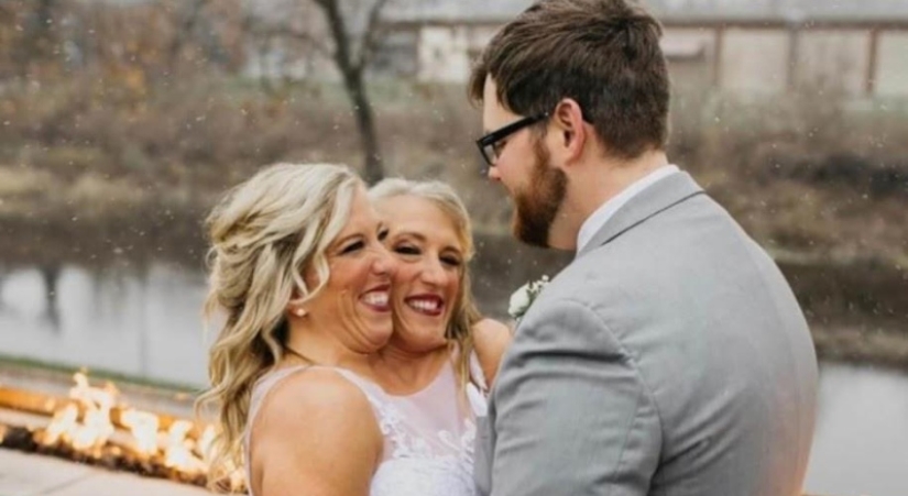 One of the sisters of the Siamese twins Hensel got married One of the sisters of the Siamese twins Hensel got married