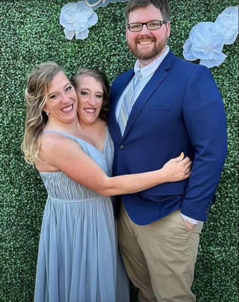 One of the sisters of the Siamese twins Hensel got married One of the sisters of the Siamese twins Hensel got married