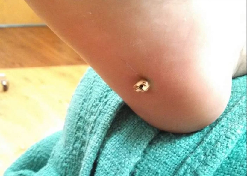 People Share Pictures That Make Others ‘Suffer’, And It Gets Worse The More You Look At Them