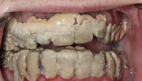 People Share Pictures That Make Others ‘Suffer’, And It Gets Worse The More You Look At Them