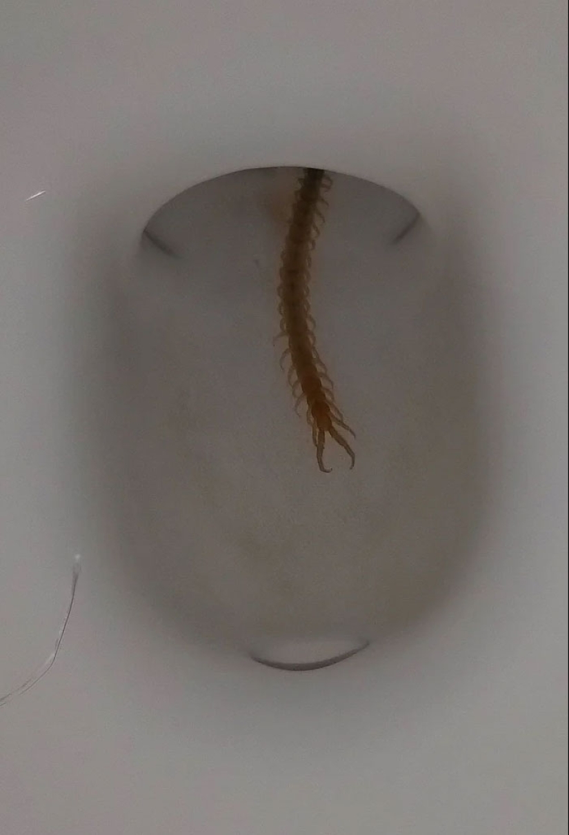 People Share Pictures That Make Others ‘Suffer’, And It Gets Worse The More You Look At Them