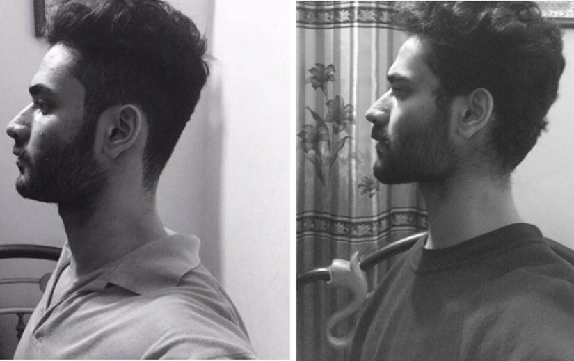 Qué es el maullido y cómo ayuda a corregir la forma de la cara Qué es el maullido y cómo ayuda a corregir la forma de la cara