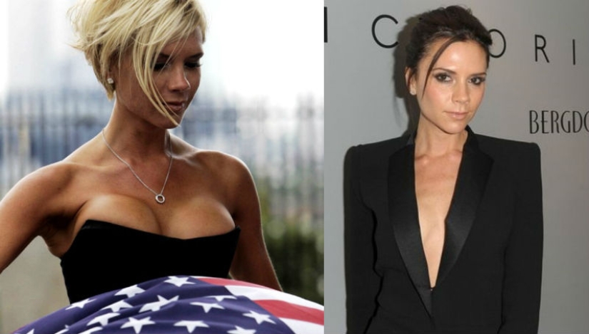 See above: Stars who have had breast reduction surgery See above: Stars who have had breast reduction surgery