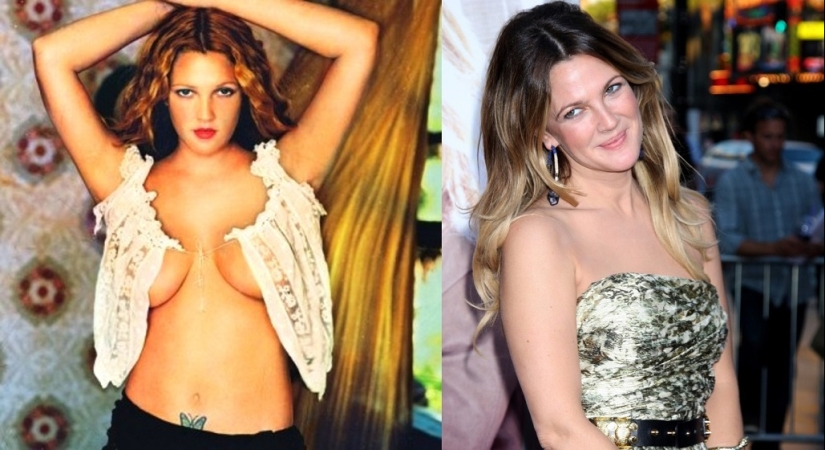 See above: Stars who have had breast reduction surgery See above: Stars who have had breast reduction surgery