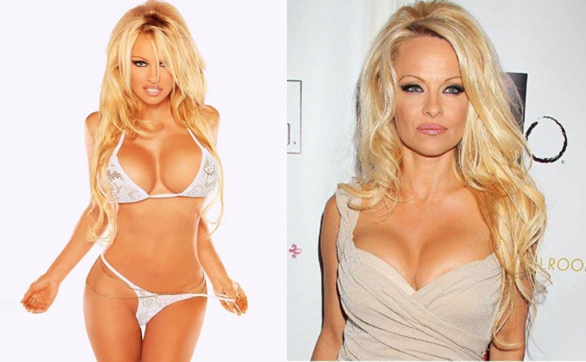 See above: Stars who have had breast reduction surgery See above: Stars who have had breast reduction surgery