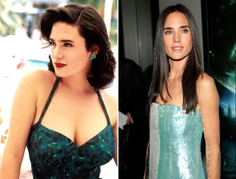 See above: Stars who have had breast reduction surgery See above: Stars who have had breast reduction surgery