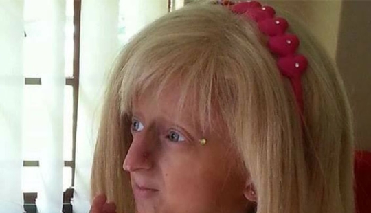 Teen Who Aged 8 Times Faster And Dreamed Of Marrying Passes Away Before Christmas