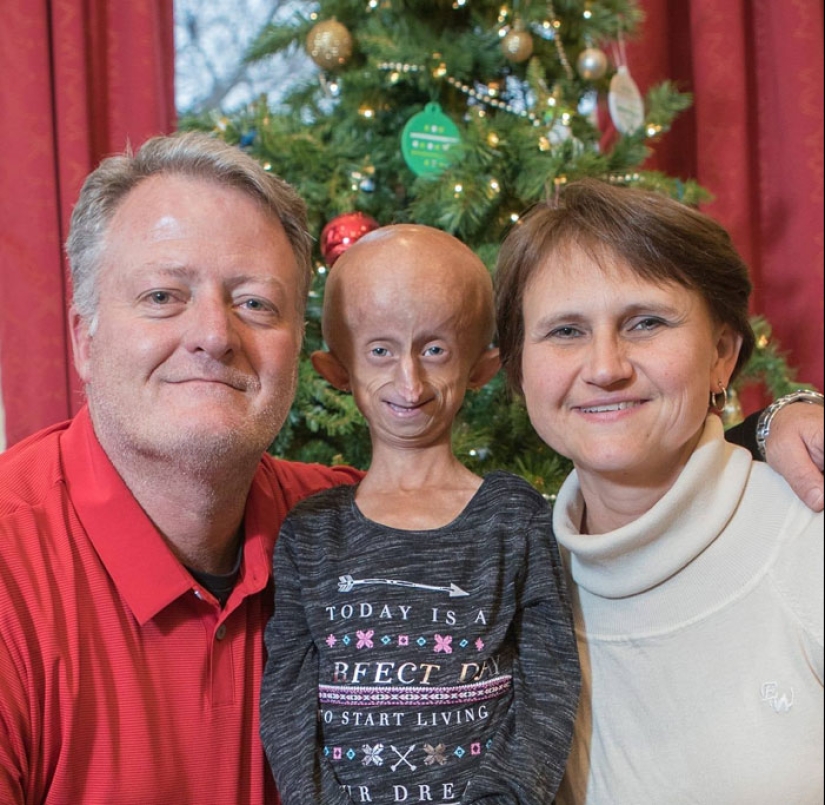 Teen Who Aged 8 Times Faster And Dreamed Of Marrying Passes Away Before Christmas Teen Who Aged 8 Times Faster And Dreamed Of Marrying Passes Away Before Christmas